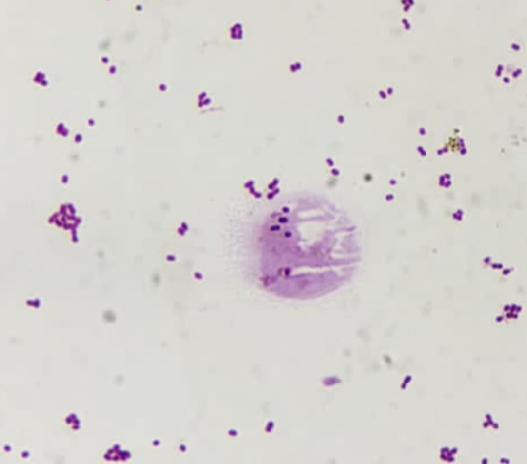 15. Diplococci Spp. Microscopic